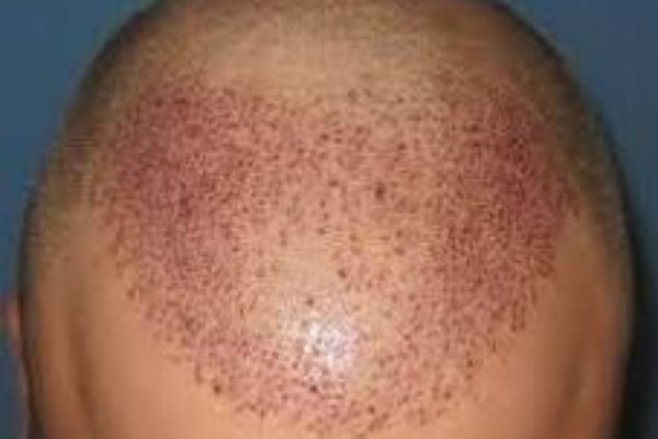 Article image for Help for your hair with Dr Paul Green