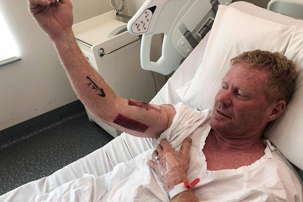 Article image for Shark attack victim has no hard feelings: ‘It just reacted to me headbutting it’