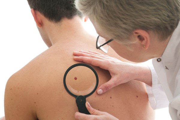 Australia has highest rate of invasive melanoma