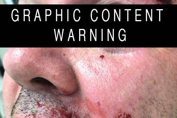 Bashed policeman left with horrific injuries but attackers granted bail