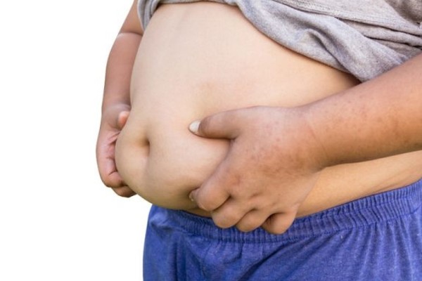 Queensland in the grip of a childhood obesity crisis