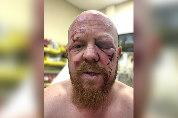 Article image for Paramedic bashed during charity bike ride
