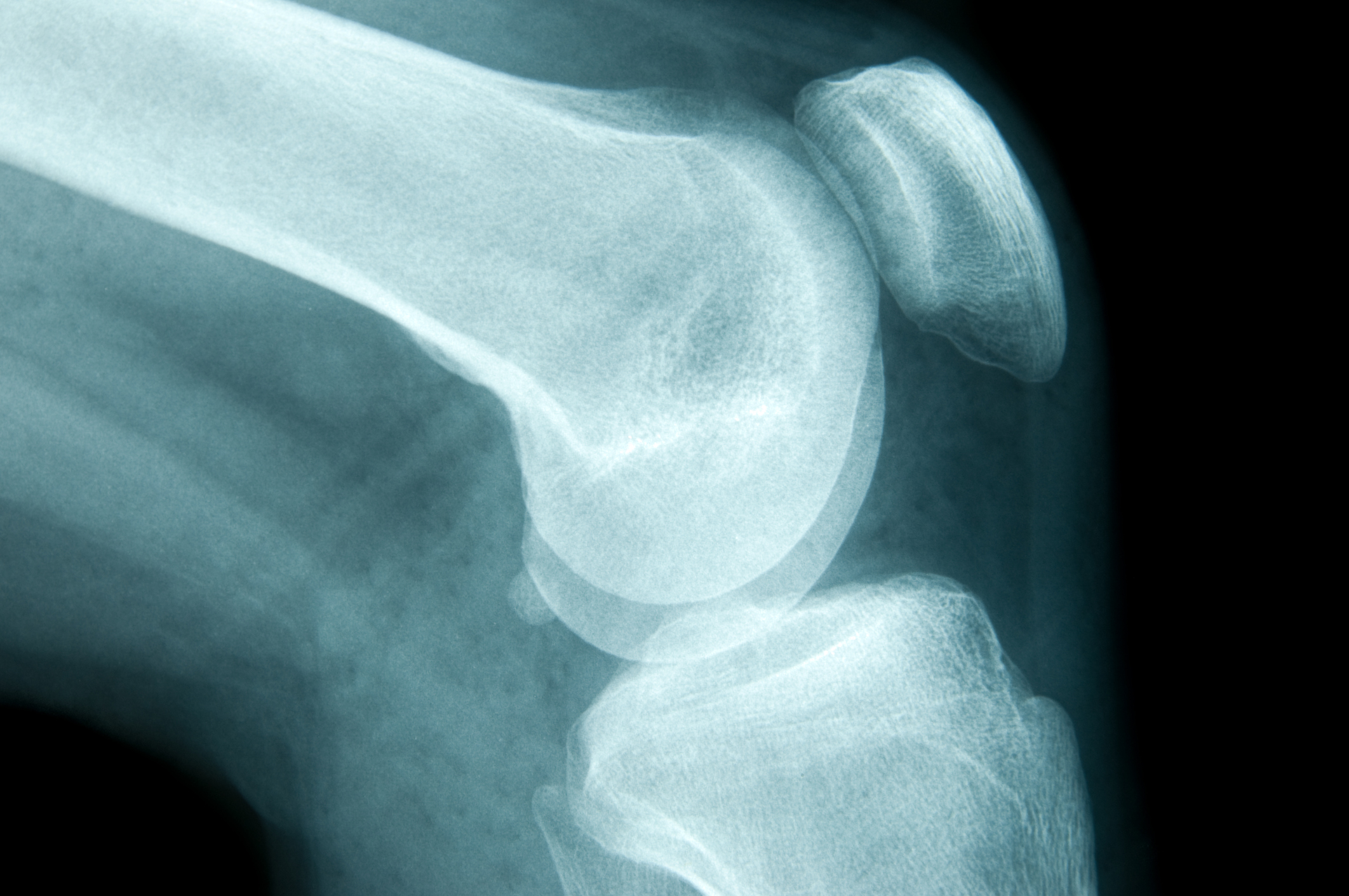 Article image for The ‘silent disease’ that’s affecting many Australians