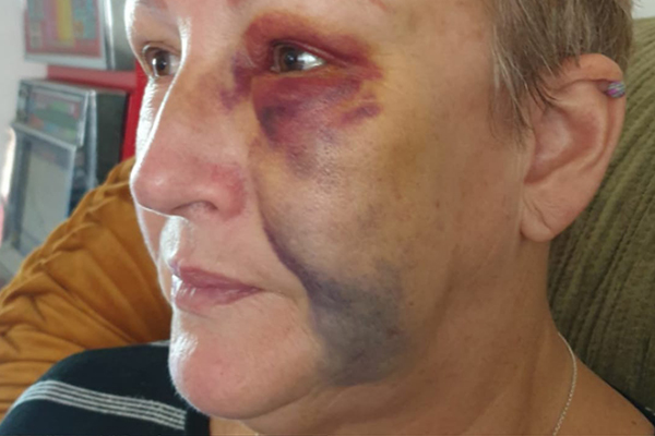Article image for ‘Head-scratching’ punishment for patient who attacked NSW nurse