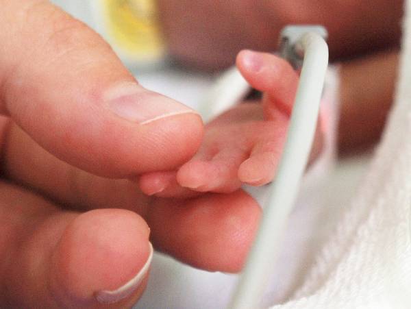 Article image for New hope for treatment of life-threatening condition in premature babies