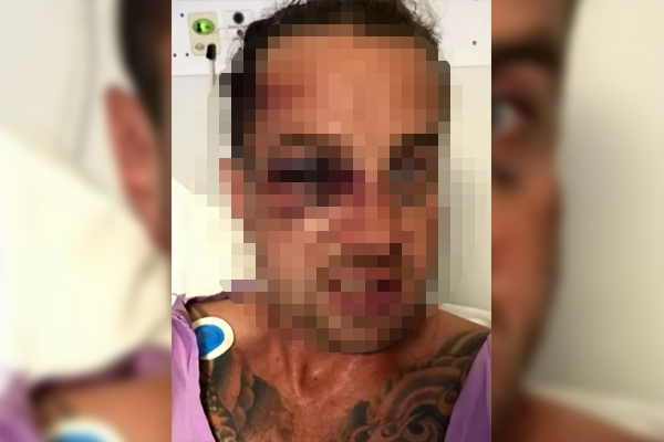 Article image for Horrific injuries of father allegedly bashed at junior football shared