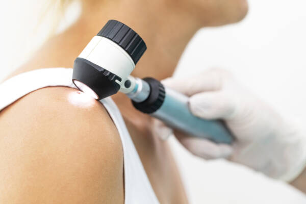The Mole Code: QIMR researchers reveal huge skin cancer breakthrough - 4BC