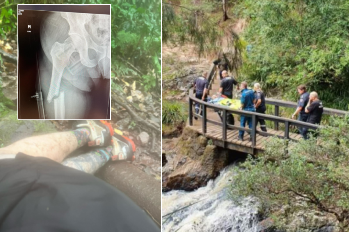 Article image for Marathon runner’s incredible rescue after breaking his leg on secluded track