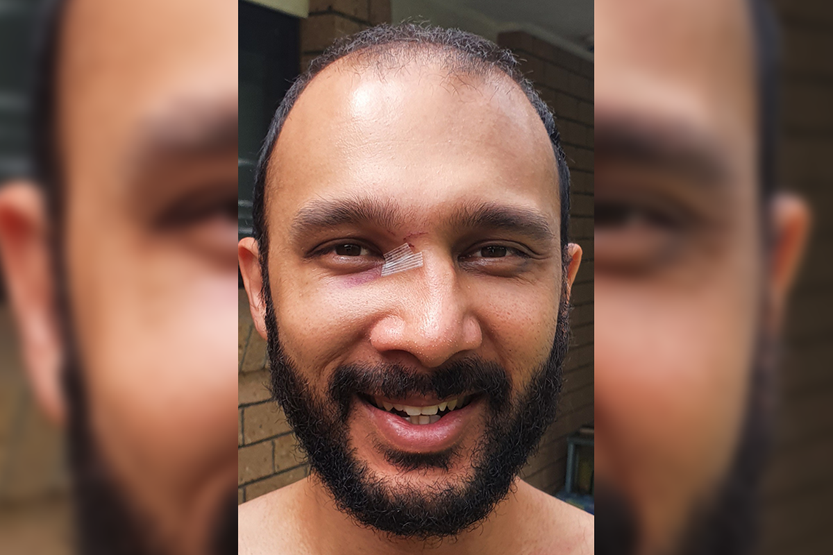 Article image for Brisbane councillor punched in the face, suffers broken nose