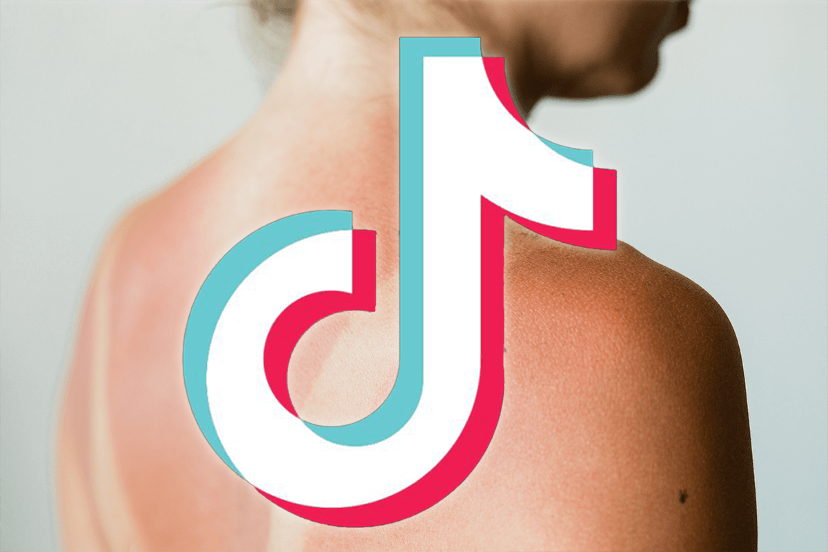 Article image for ‘That’s cooked’: TikTok’s answer to dangerous ‘sunburn challenge’ trend 