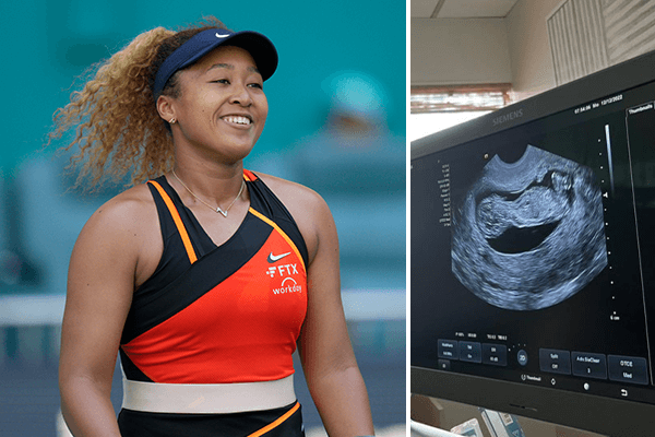 Article image for Naomi Osaka announces pregnancy, plans to return to competition