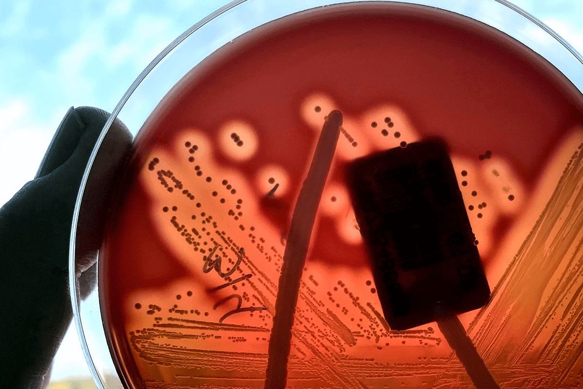 Article image for Strep A cases on the rise among Australian kids, health authorities warn